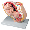 만삭 임신 골반 모형